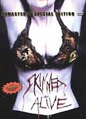 Skinned Alive