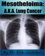 Mesothelioma: A.K.A. Lung Cancer