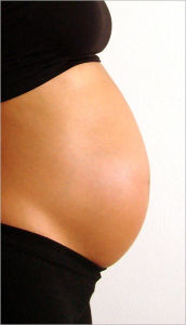 Title: The Truth about Preventing and Getting Rid of Stretch Marks, Author: Deborah Green