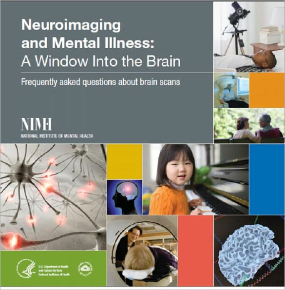 Neuroimaging and Mental Illness: A Window Into the Brain: Frequently asked questions about brain scans