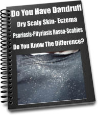 Title: Do You Have Dandruff-Dry Scaly Skin- Eczema- Psoriasis-Pityriasis Rosea-Scabies- Do You Know The Difference?, Author: James Dodson