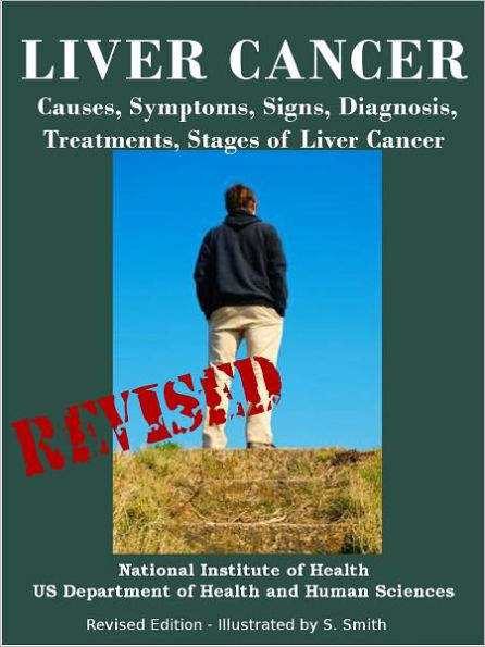 LIVER CANCER: Causes, Symptoms, Signs, Diagnosis, Treatments, Stages of Liver Cancer - Revised Edition - Illustrated by S. Smith