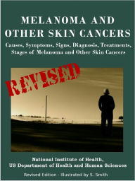 Title: MELANOMA AND OTHER SKIN CANCERS: Causes, Symptoms, Signs, Diagnosis, Treatments, Stages of Melanoma and Other Skin Cancers, Author: U.S. DEPARTMENT OF HEALTH AND HUMAN SERVICES