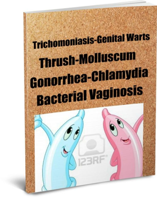 Trichomoniasis Genital Warts Thrush Molluscum Gonorrhea Chlamydia