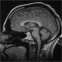 Psychology of the Unconscious : A Study of the Transformations and Smbolisms of the Libido : a Contribution to the History of the Evolution of Thought (1916)