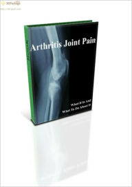Title: Arthritis Joint Pain, Author: Alan Smith