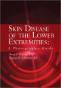 Skin Disease of the Lower Extremities:A Photographic Guide