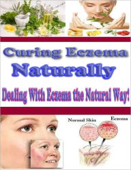 Title: Curing Eczema Naturally, Author: David Colon