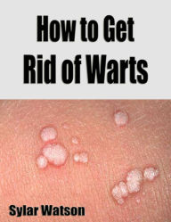 How to Get Rid of Warts