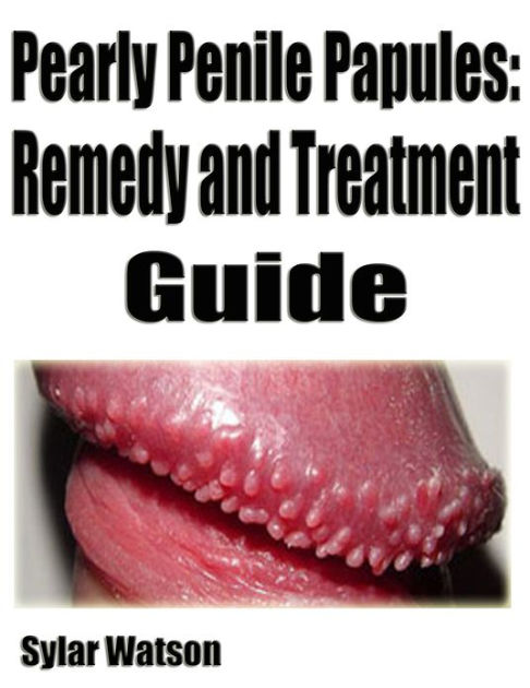 Papules is penile it what Pearly penile
