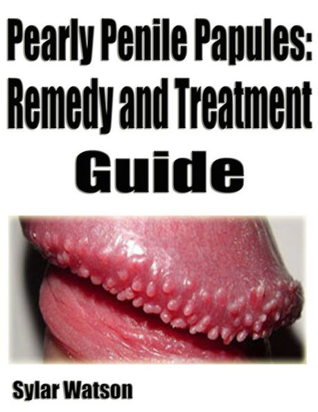 Pearly Penile Papules: Remedy and Treatment Guide 