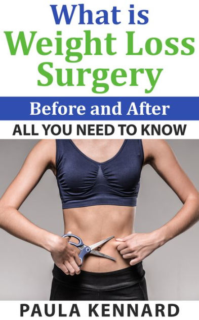 what-is-weight-loss-surgery-all-you-need-to-know-before-and-after-by