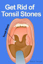 Get Rid of Tonsil Stones: Causes, Symptoms, Treatment, Removal and Other Remedies
