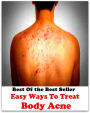 Best of the best sellers Easy Ways To Treat Body Acne ( exercise, meditation, acupuncture, disease, digestive system, formula, medicine, remedy, fix, treatment, action, conduct, behavior, handling, gastrin, fitness, vitamins, healing )