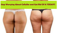 Title: Stop Worrying About Cellulite And Get Rid Of It Today!, Author: Christopher McNeil