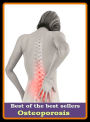 Best of the best sellers Osteoporosis ( Brittle bones, Brittle bone disease, see there, )