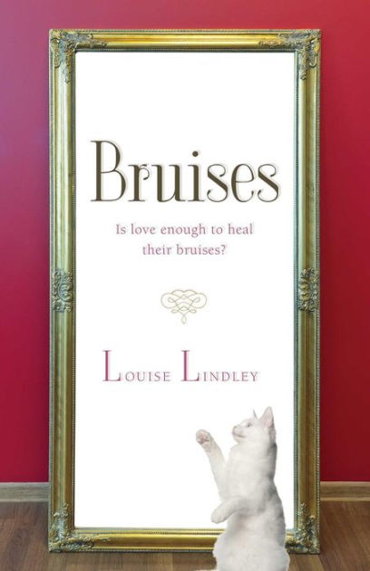 Louise Painedavey on X: Leg update. So sore. Bruise on back is massive.  Would show you all but involves bra strap so may be taken down by Twitter  lol. Suffice to say