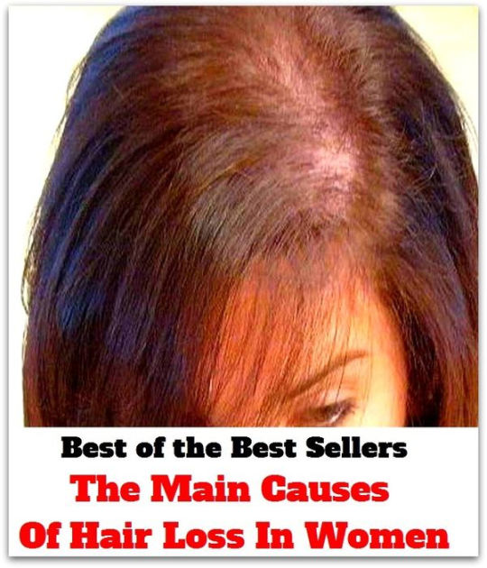 hair loss in women causes