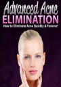 Best Ways to Advanced Acne Elimination - Youu