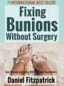 Fixing Bunions Without Surgery: How To Avoid Ending Up With Feet Like Your Mother