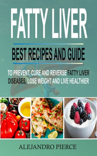 Fatty Liver Best Recipes And Guide To Prevent Cure And Reverse Fatty