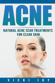 Title: ACNE - Natural Acne Scar Treatments for Clear Skin, Author: Vicki Joy