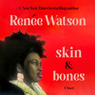 skin & bones: a novel