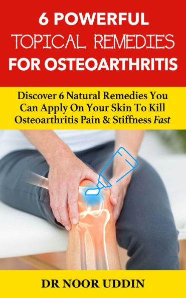 6 Powerful Topical Remedies For Osteoarthritis: Discover 6 Natural Remedies You Can Apply On Your Skin To Kill Osteoarthritis Pain & Stiffness Fast