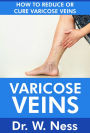 Varicose Veins