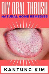 Title: DIY Oral Thrush Natural Home Remedies, Author: Kantung Kim