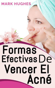 Title: Formas Efectivas De Vencer El Acné, Author: Mark Hughes