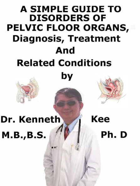A Simple Guide to Disorders of Pelvic Floor Organs, Diagnosis, Treatment and Related Conditions