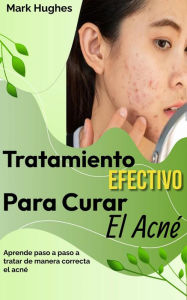 Title: Tratamiento Efectivo Para Curar El Acné: Aprende paso a paso a tratar de manera correcta el acné, Author: Mark Hughes