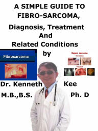 Title: A Simple Guide to Fibro-sarcoma, Diagnosis, Treatment and Related Conditions, Author: Kenneth Kee
