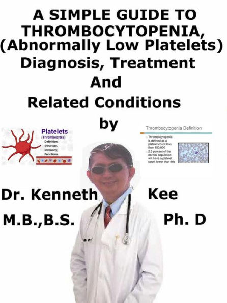 A Simple Guide to Thrombocytopenia (Abnormally Low Platelets), Diagnosis, Treatment and Related Conditions