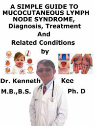 Title: A Simple Guide to Mucocutaneous Lymph Node Syndrome (Kawasaki Disease), Diagnosis, Treatment and Related Conditions, Author: Kenneth Kee