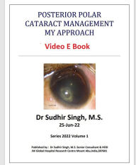 Title: Posterior Polar Cataract Management: My Approach (2022, #1), Author: Sudhir Singh
