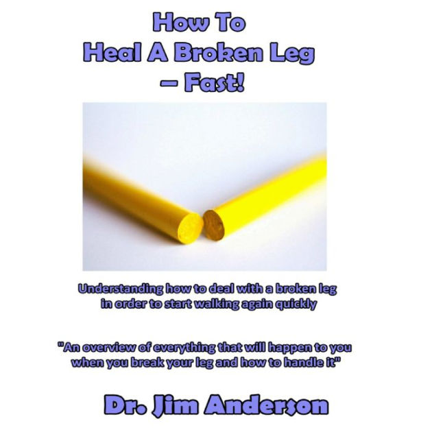 how-to-heal-a-broken-leg-fast-understanding-how-to-deal-with-a