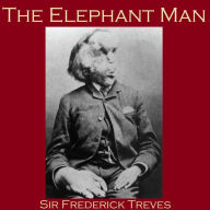 The Elephant Man