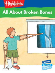 All About Broken Bones: Voices Leveled Library Readers