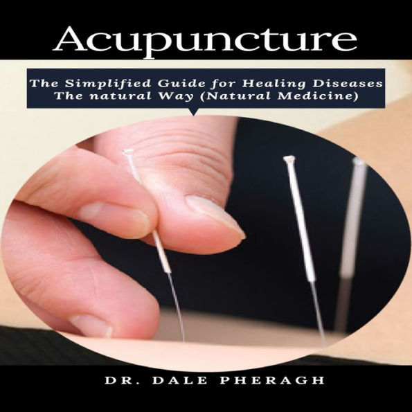 Acupuncture: The Simplified Guide for Healing Diseases The natural Way (Natural Medicine)