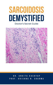 Title: Sarcoidosis Demystified: Doctor's Secret Guide, Author: Dr. Ankita Kashyap
