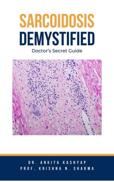 Sarcoidosis Demystified: Doctor's Secret Guide