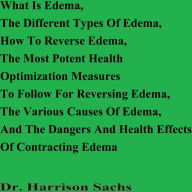 Title: What Is Edema, The Types Of Edema, How To Reverse Edema, And The Dangers And Health Effects Of Contracting Edema, Author: Dr. Harrison Sachs