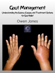 Title: Gout Management: Understanding the Science, Causes, and Treatment Options for Gout Relief, Author: Owen Jones