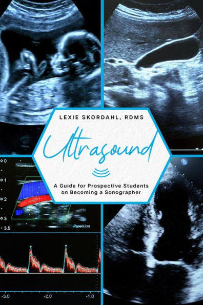 Ultrasound: A Guide for Prospective Students on Becoming a Sonographer