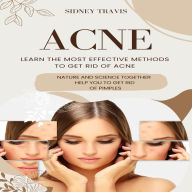 Acne: Learn the Most Effective Methods to Get Rid of Acne (Nature and Science Together Help You to Get Rid of Pimples)