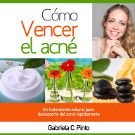 Cómo Vencer el Acné: Un tratamiento natural para deshacerte del acné rápidamente