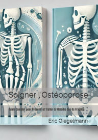 Soigner l'Ostéoporose: Guide Complet pour Prévenir et Traiter la Maladie des Os Fragiles