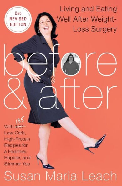 Before & After, Second Revised Edition: Living and Eating Well After Weight-Loss Surgery